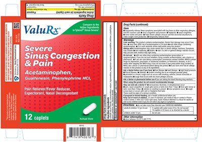 Severe Sinus Carton (Severe Sinus Carton)